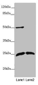 ARHGDIG Antibody