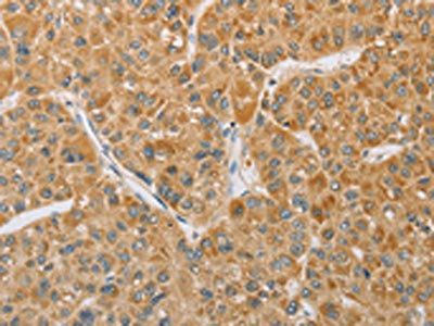 ARHGEF1 Antibody
