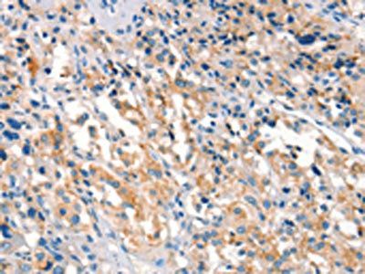 ARHGEF11 antibody