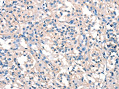 ARHGEF11 Antibody