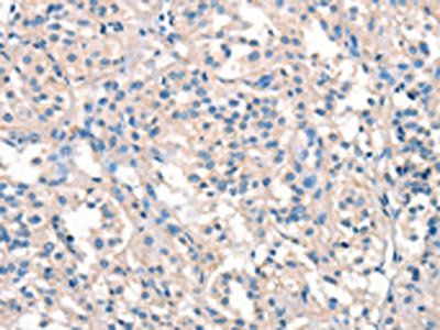 ARHGEF11 antibody