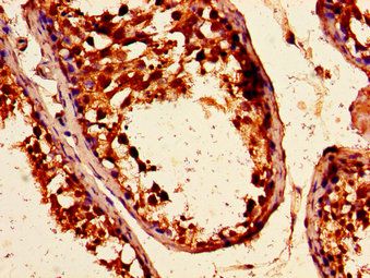 ARHGEF12 Antibody