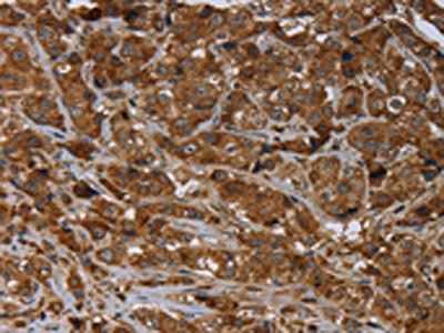 ARHGEF12 Antibody