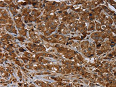 ARHGEF12 antibody