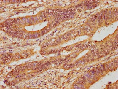 ARHGEF18 Antibody
