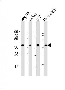 ARHGEF39 antibody