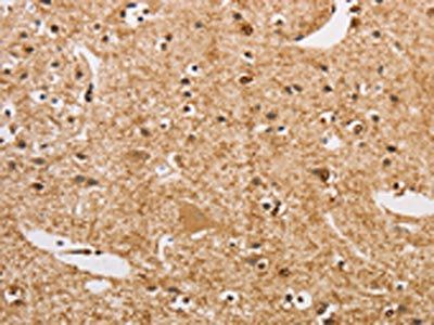 ARHGEF5 Antibody