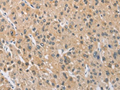ARHGEF5 Antibody