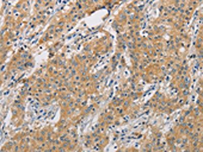 ARHGEF7 Antibody