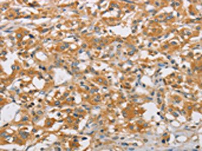 ARHGEF7 Antibody