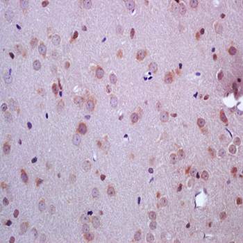 ARHI Rabbit Polyclonal Antibody