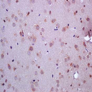 ARHI antibody