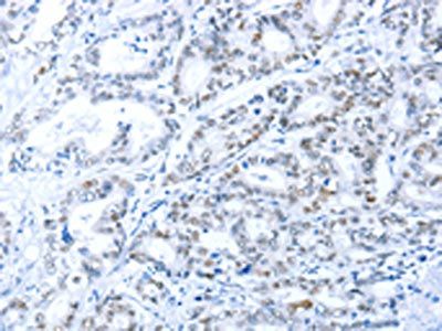 ARID1A Antibody