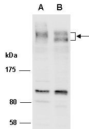 ARID1B (N) Antibody, Rabbit Polyclonal