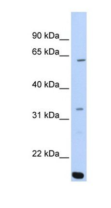 ARID5A antibody