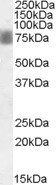 Goat anti-ARK5 / NUAK1 Antibody