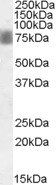 NUAK1 antibody