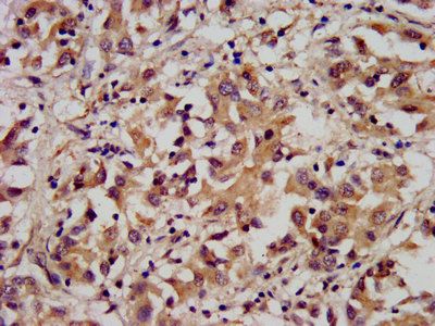 ARL1 Antibody
