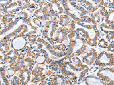 ARL11 antibody