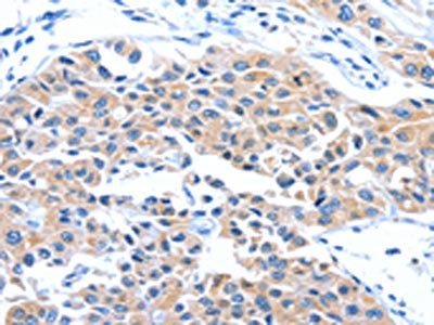 ARL11 Antibody