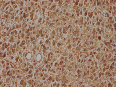 ARL2BP Antibody