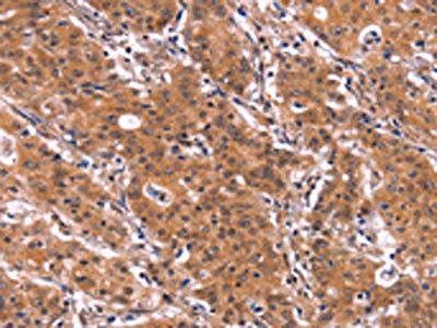 ARL4A Antibody