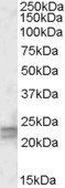 Goat anti-ARL4D Antibody
