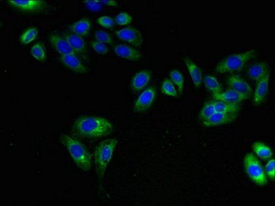 ARL6IP1 antibody