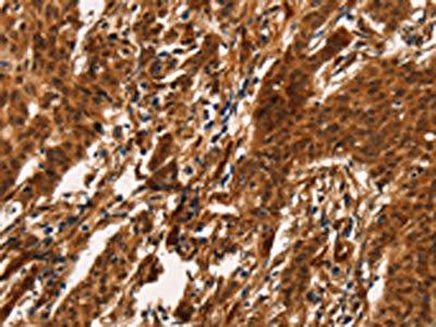 ARL6IP1 antibody