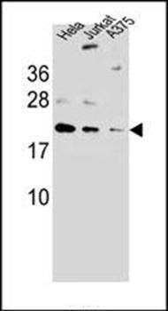 ARL6IP6 antibody