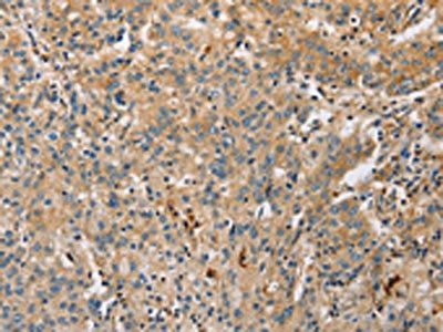 ARL8A Antibody