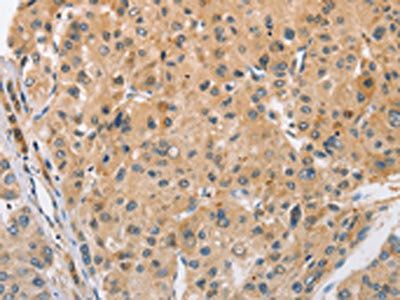 ARL8A Antibody