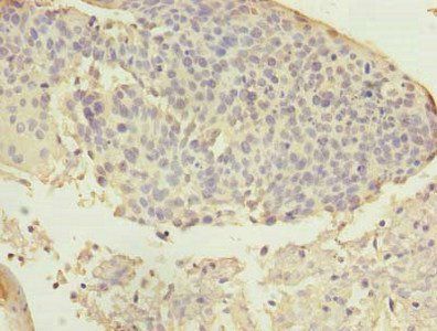 ARMC7 Antibody