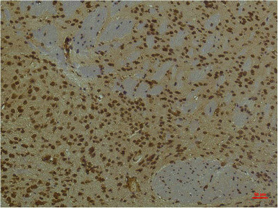 ARNT Monoclonal Antibody