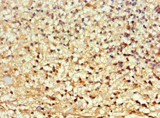 ARNT2 Antibody