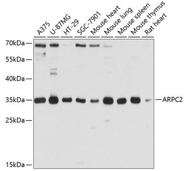 ARPC2 antibody