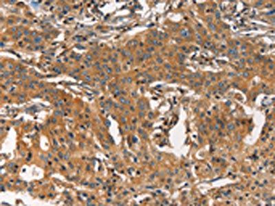 ARPC2 Antibody