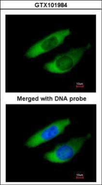 actin related protein 2/3 complex subunit 2 Antibody