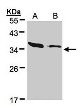 ARPC2 antibody