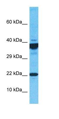 ARPC4 antibody
