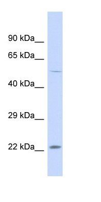 ARPC4-TTLL3 antibody