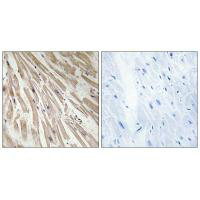 ARPP21 Antibody