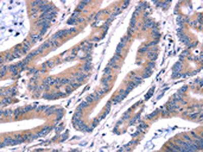 ARRB1 Antibody
