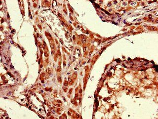 ARRDC1-AS1 Antibody