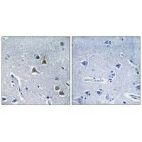 ARRDC2 antibody