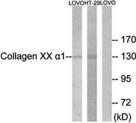 Collagen XX α1 Antibody