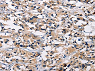 ARSB Antibody