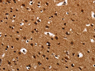 ARSB Antibody