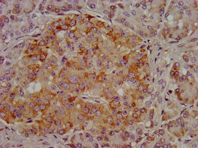 ARSE Antibody