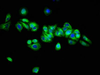 ARSH Antibody